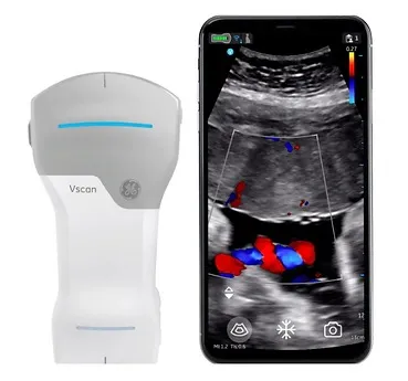 超音波画像検査装置 (エコー)